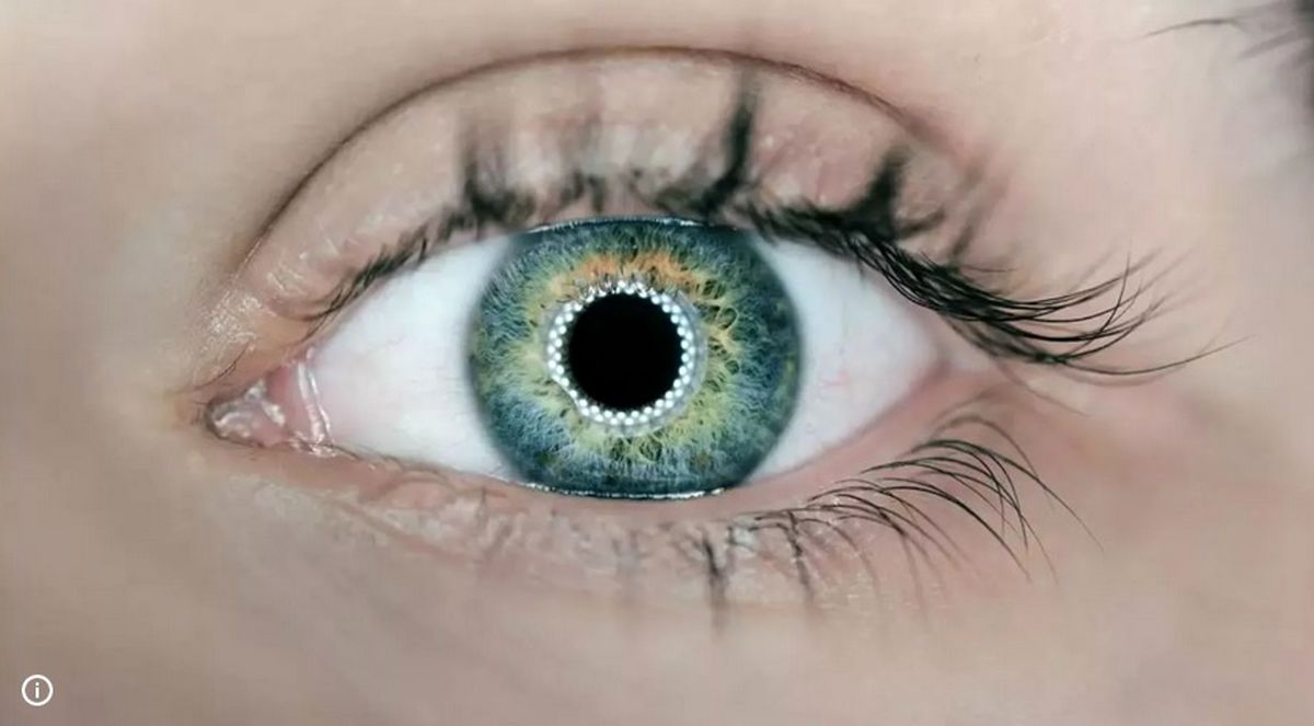 چگونه یک آزمایش ساده چشم به تشخیص و پیش‌بینی حملات قلبی کمک می‌کند؟ 