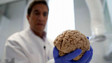 مغز ساخته شده توسط دانشمندان در آزمایشگاه، برای خود چشم ساخت!/ عکس